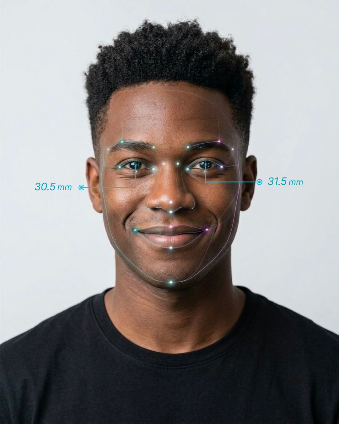 Facial scan showing asymmetric pupillary distance measurements with left eye at 30.5mm and right eye at 31.5mm